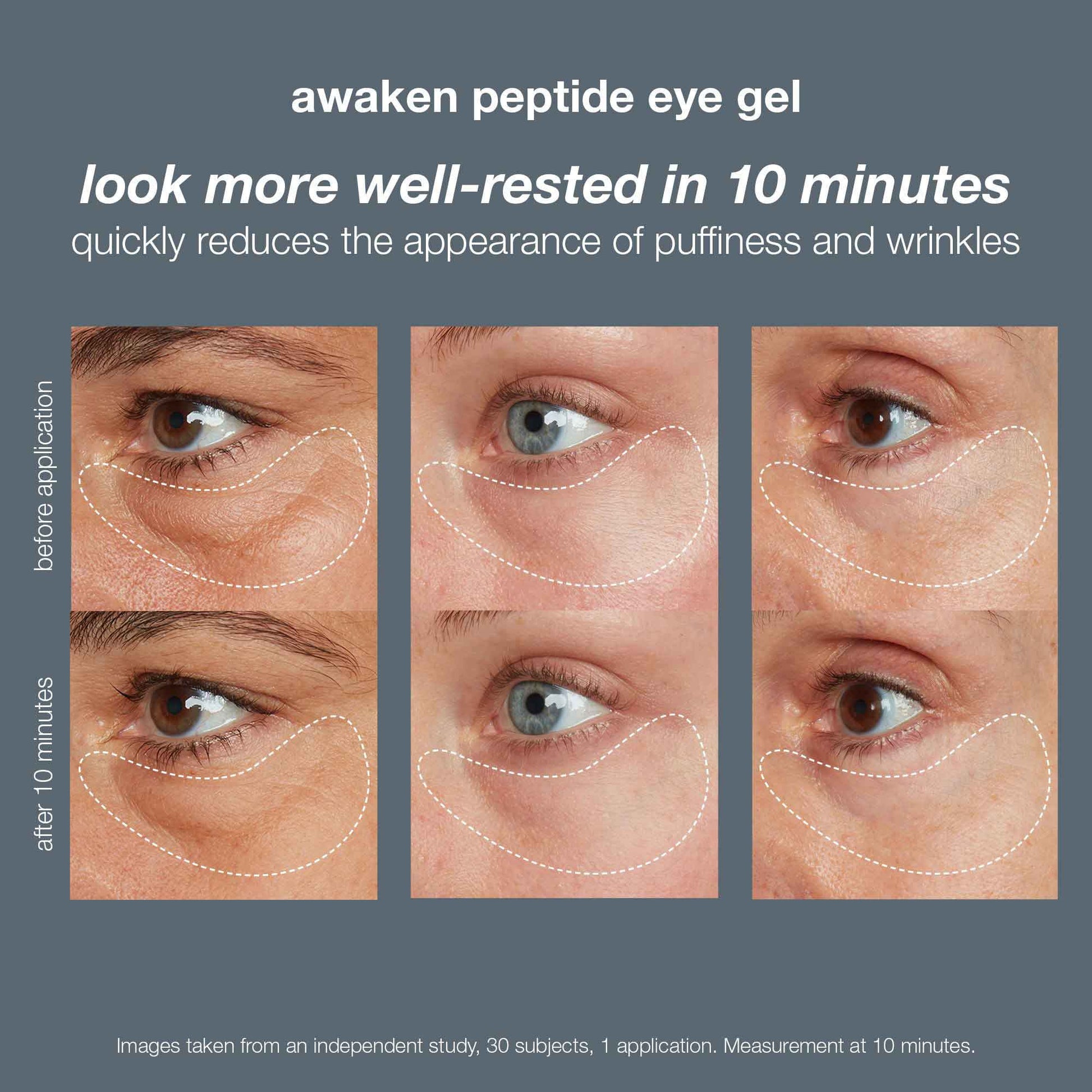 Smart second skin reduces eye bags and wrinkles – or so it seems